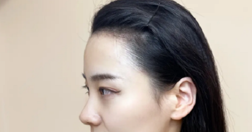 女性額頭寬大發際線高面相好不好？