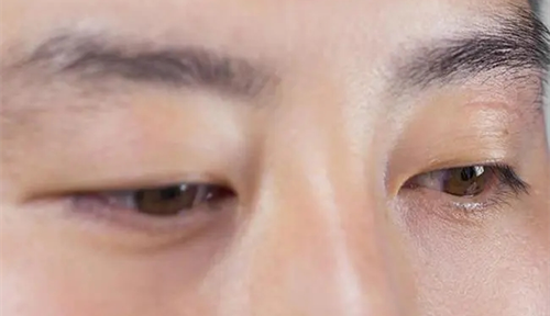 男人的左眼跳是什么預兆 男人左眼跳是財還是災