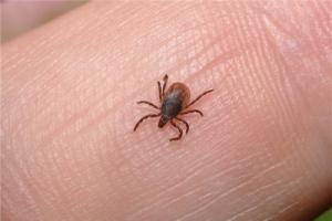 夢見頭上長虱子并掐死是什么意思