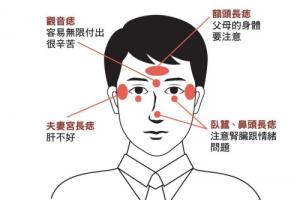 面部哪些痣必須點掉