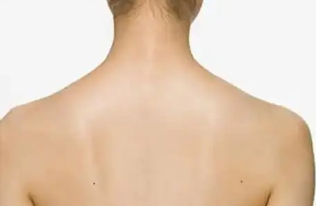 肩胛骨長(zhǎng)痣說明什么? 肩胛骨長(zhǎng)痣說明什么?
